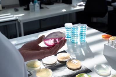 Contamination microorganisms food