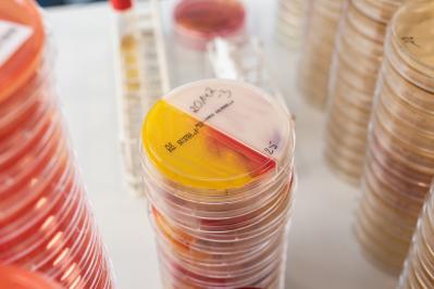 Microbiological Analysis Baby Food